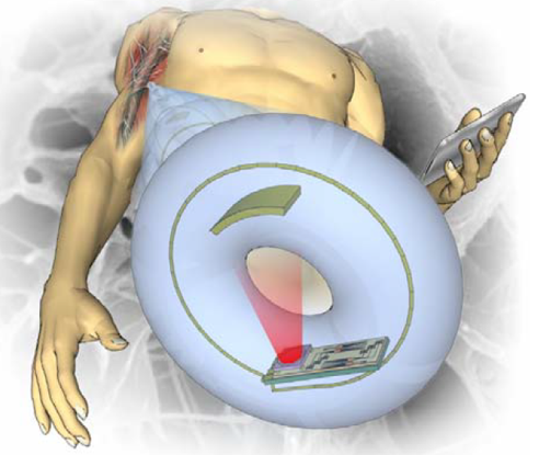 Implanteerbare glucosemeter
